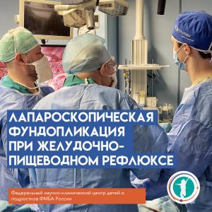 Лапароскопическая фундопликация при желудочно-пищеводном рефлюксе