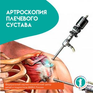 Артроскопия плечевого сустава
