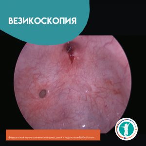 Везикоскопия